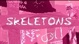 Video cover Skeletons