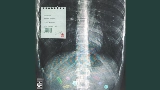 Video cover ilacın etkisi